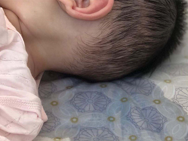 頭部經(jīng)常出汗什么原因，頭部出汗多怎么調(diào)理